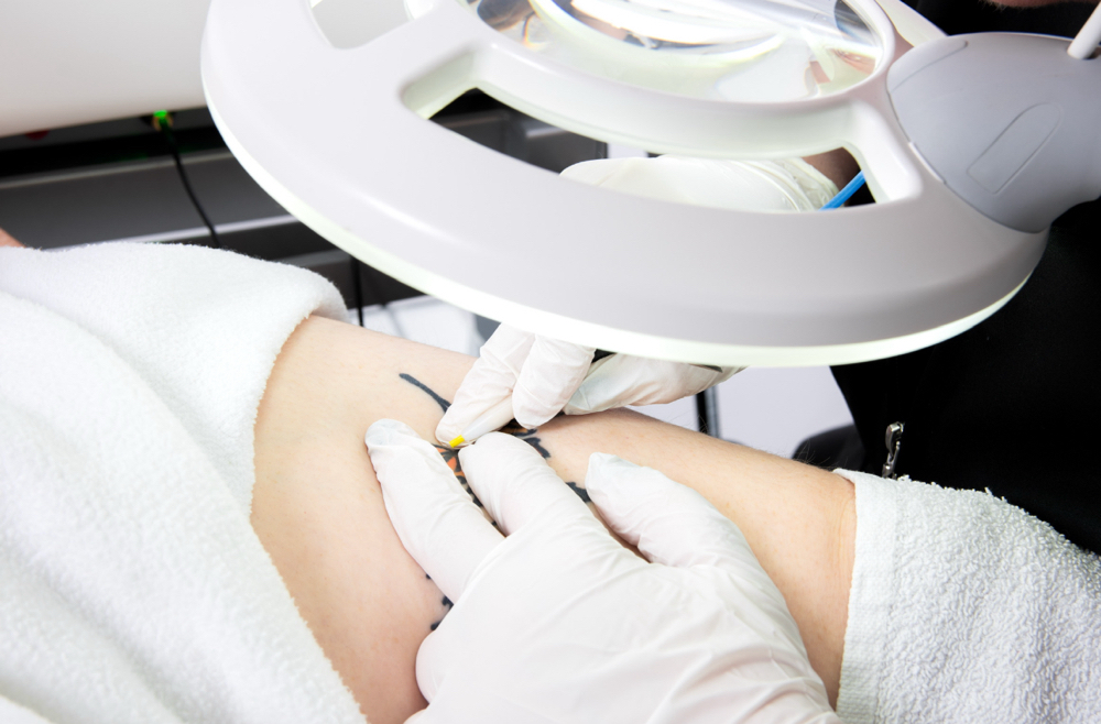 Electrolysis (Returning Client)