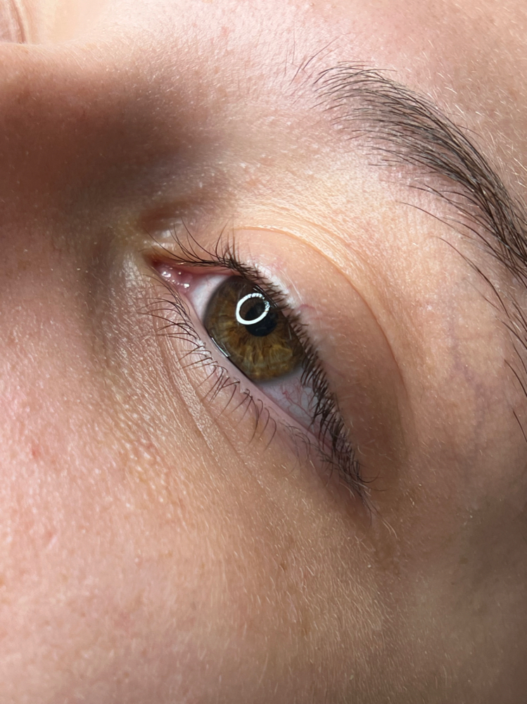 Lash Removal (foreign removal)