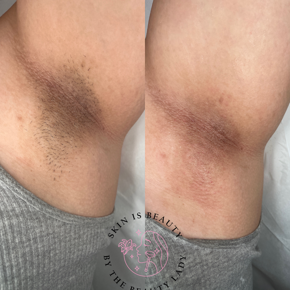 Under Arm Wax + brightening