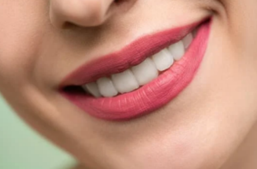 Teeth Whitening Services at Ellevate Skincare in Boise, ID
