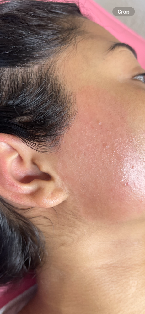 Side Burns