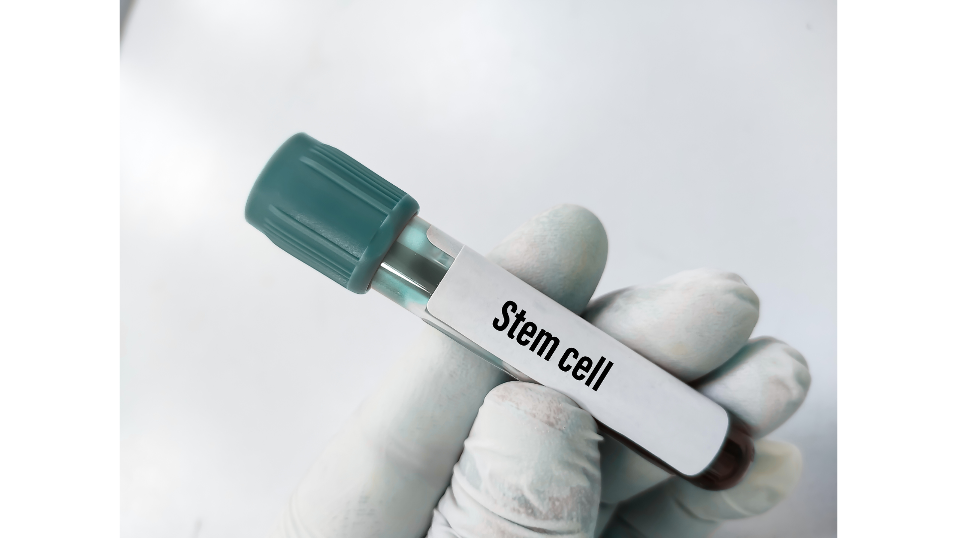 Exosome Hair Regneration