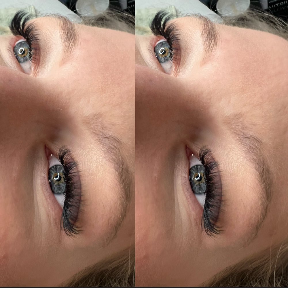 Volume Extensions (full set)