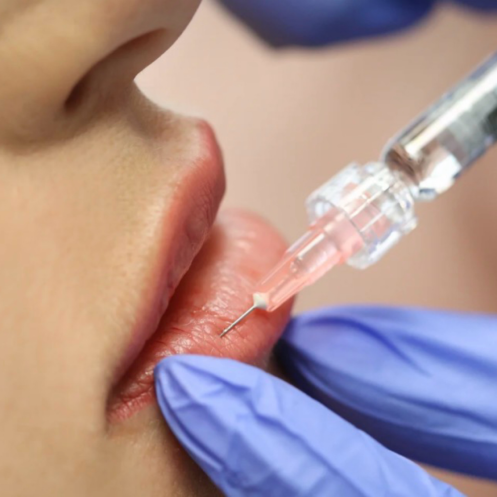 Filler at Poke Me Pretty Aesthetics in Cleburne, TX