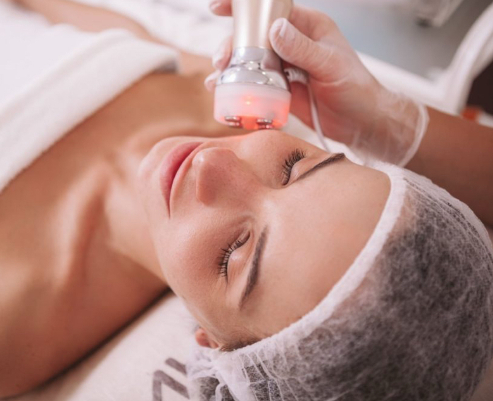 RF Lifting  Treatment Add On