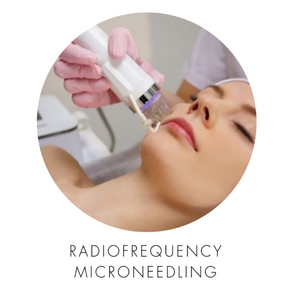 RF Face,neck at Beauty Care by Monika Wojcieszak in Rockaway, NJ