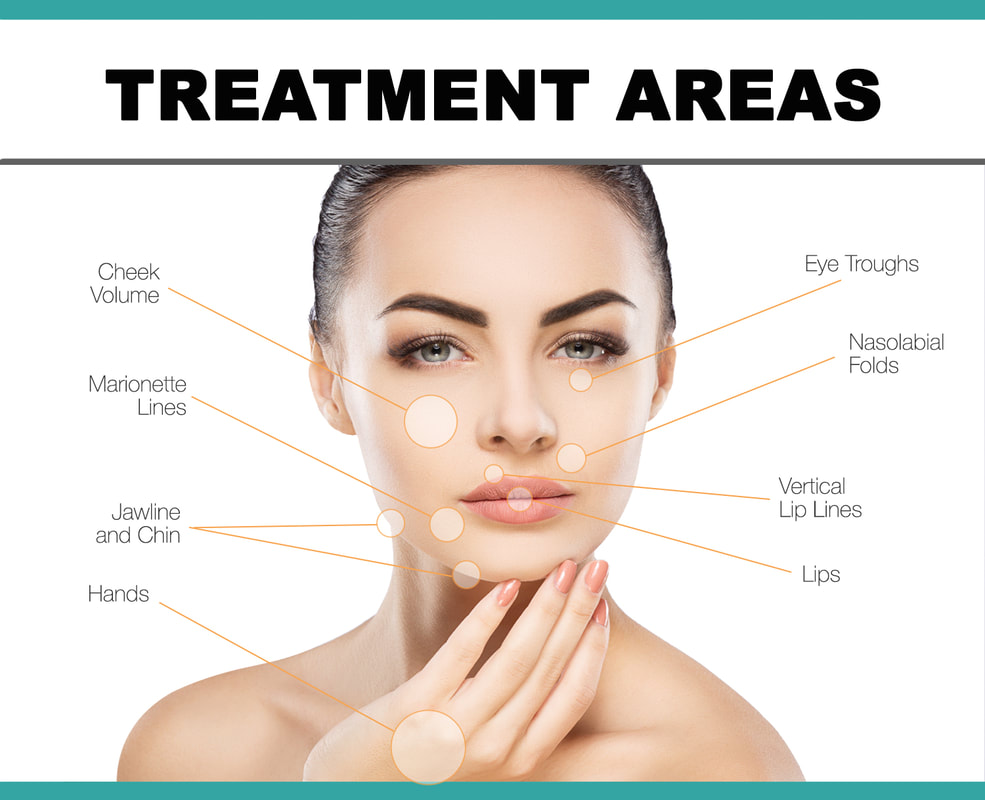 Dermal Fillers