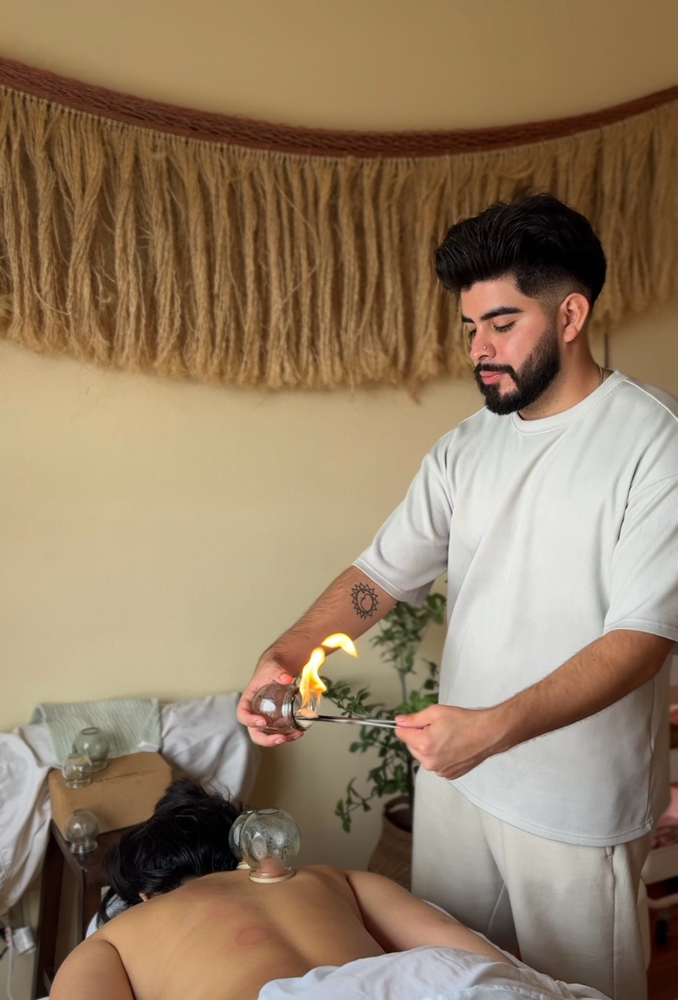 Fire Cupping Art Of Healing