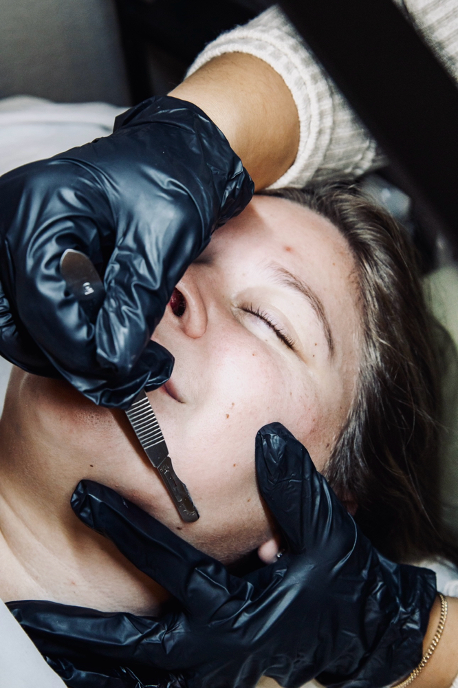 Dermaplane Facial