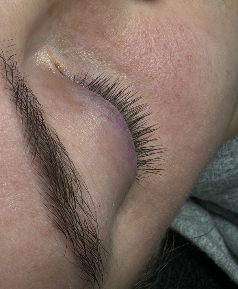 Lash Extension Removal