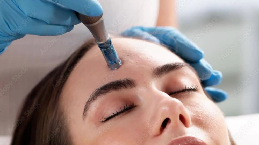 Nano Needling With EMS/Light Therep