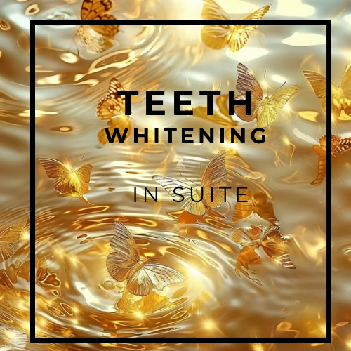 In Suite Whitening Sessions