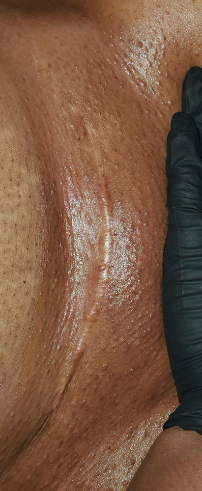 Beginner Brazilian Wax