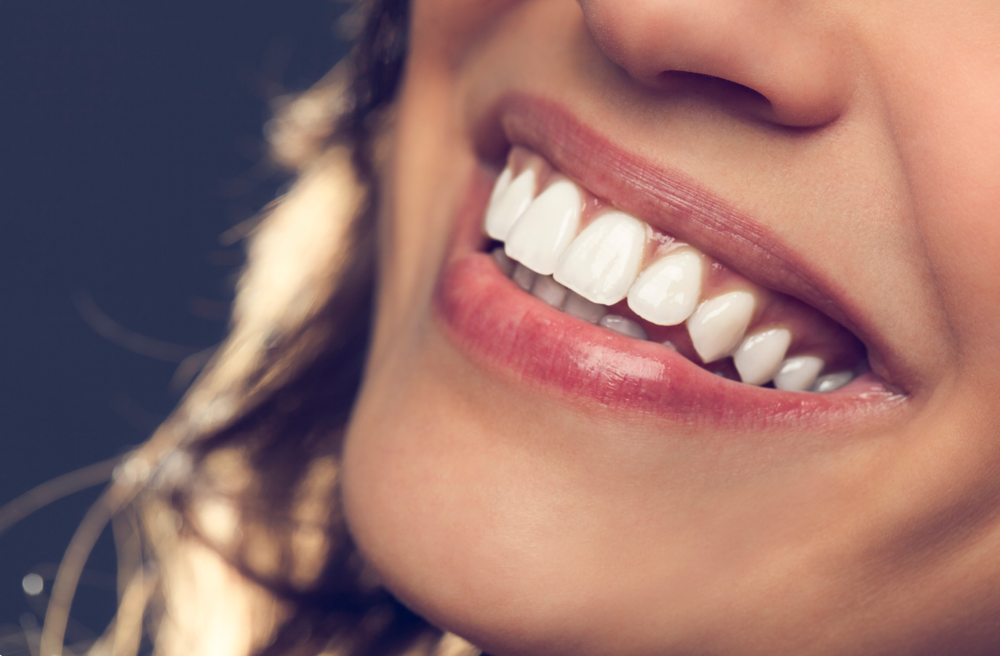 Holistic Teeth Whitening