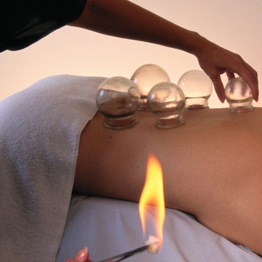 Cupping / Ventosas at Lumiee Skincare Llc in Chicago, IL