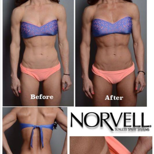 Venetian -Airbrush Spray Tan at The Tan Shack in Halfmoon, NY