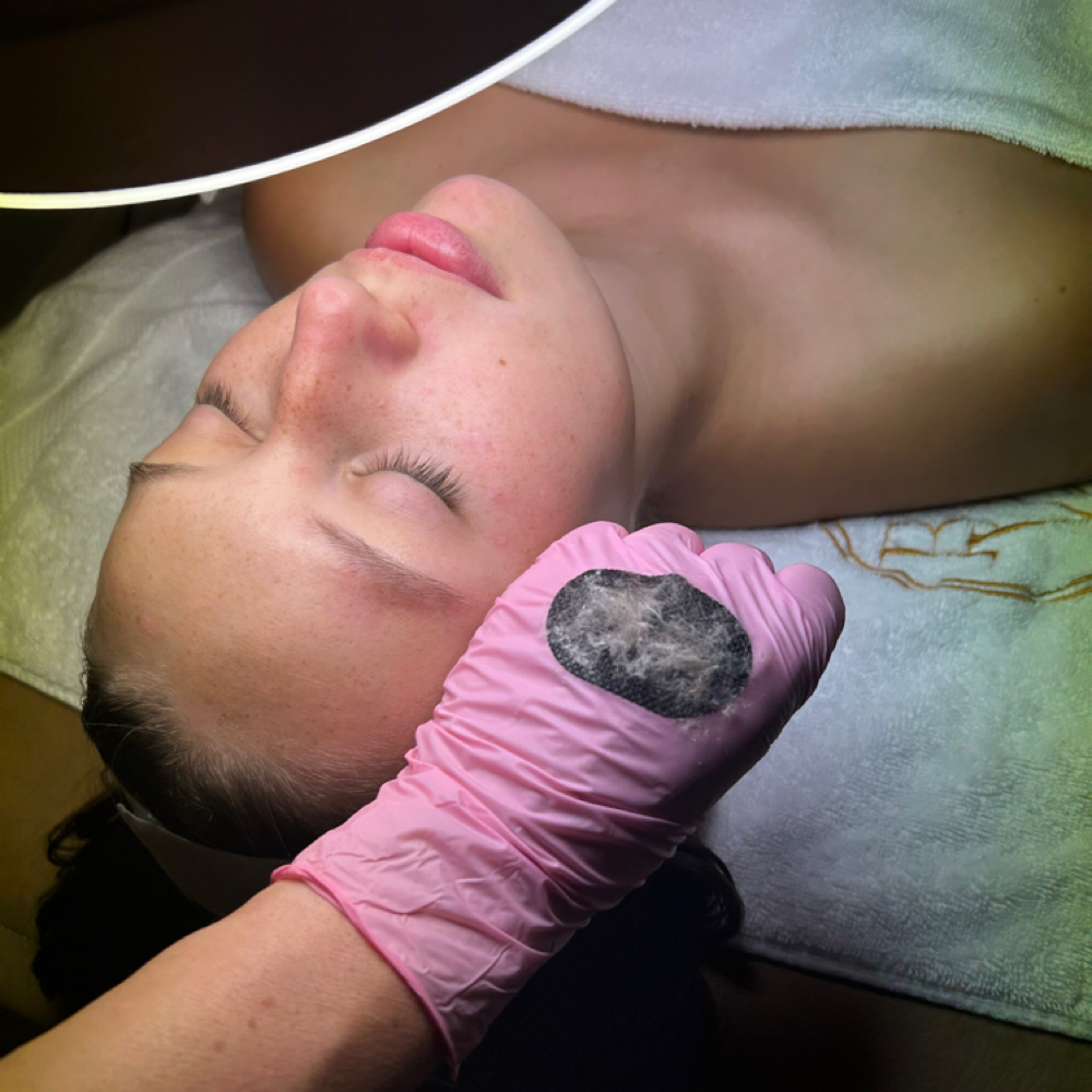 Dermaplaning+Facial at Belle Vie Esthetics by Andreia Miranda in Natick, MA