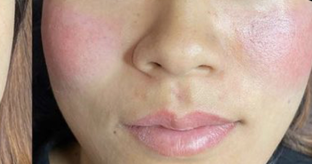 Permanent Cheek Blush at LE LUXE BEAUTY in Los Angeles, CA