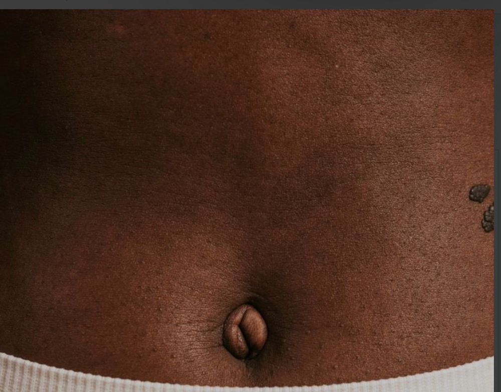 Stomach Wax Or Sugar