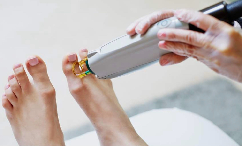 Feet Laser Hair Removal (single)