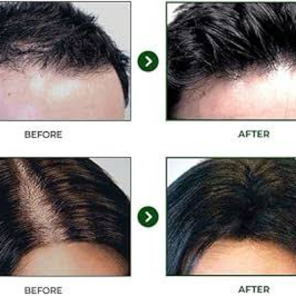 Hair Restoration at Bayou Glow, LLC in Larose, LA