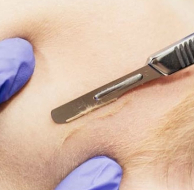 Dermaplane