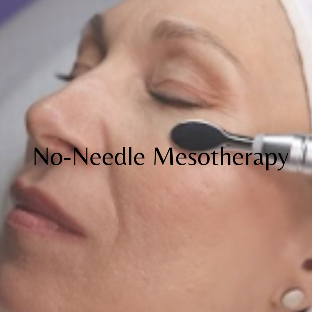 No-Needle Mesotherapy at V Spas in Watertown, MA
