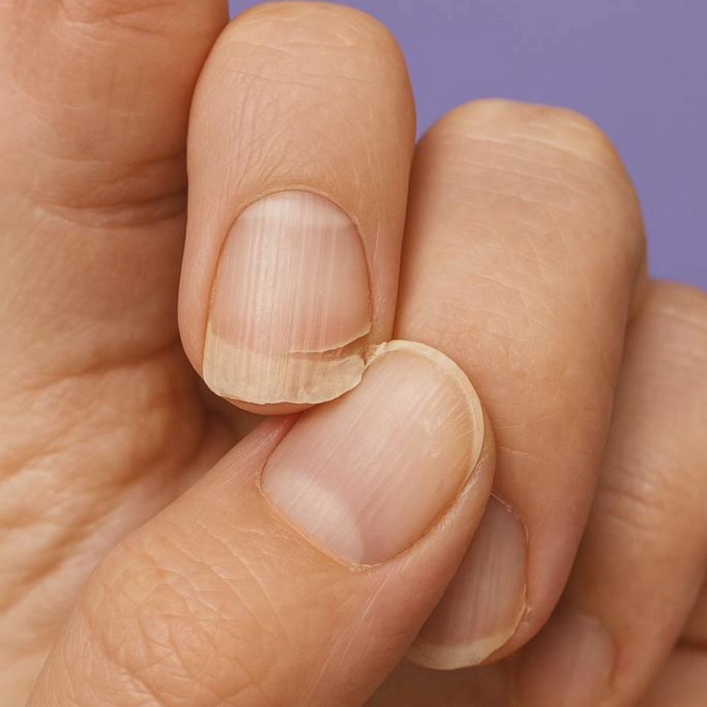 Nail Repair at Nail Loft LA in Los Angeles, CA