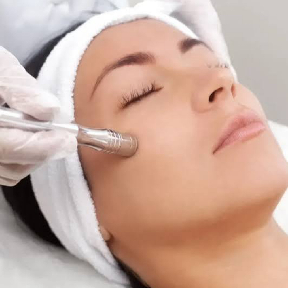 Microdermabrasion at Ipanema Skincare in St Charles, IL