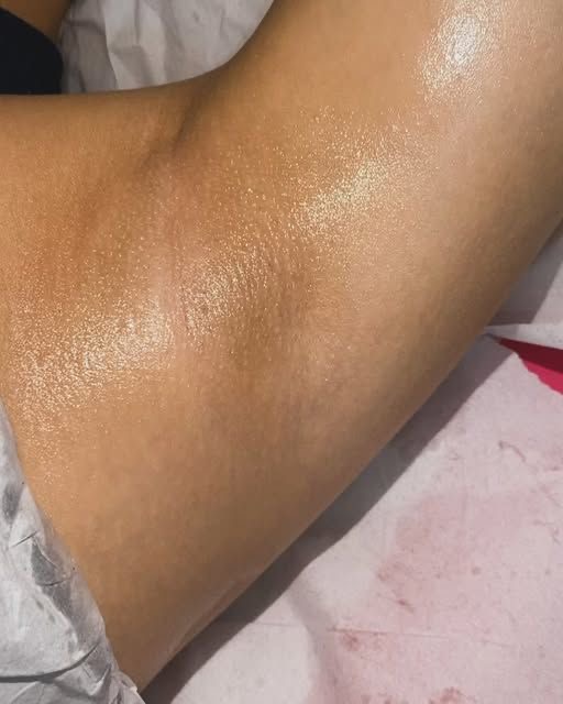 Underarms