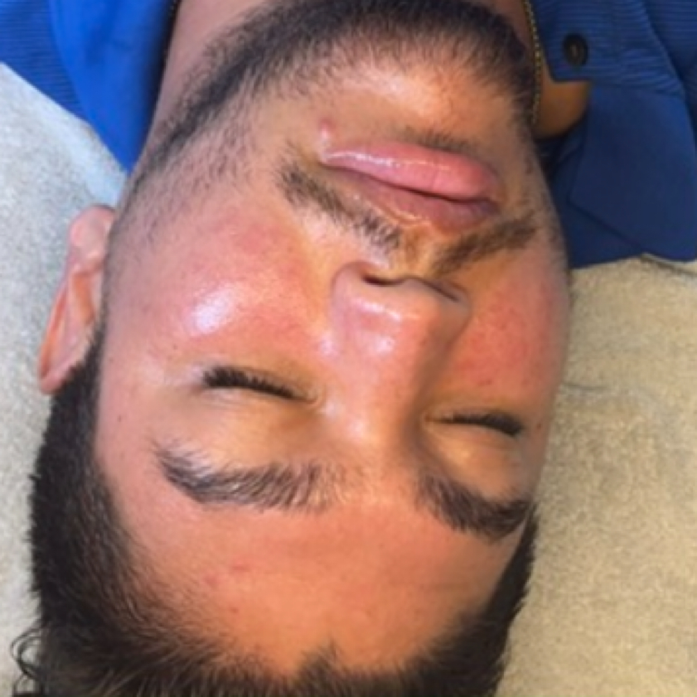 Tuxedo Facial at Treasured Living Esthetics in Rosedale, MD