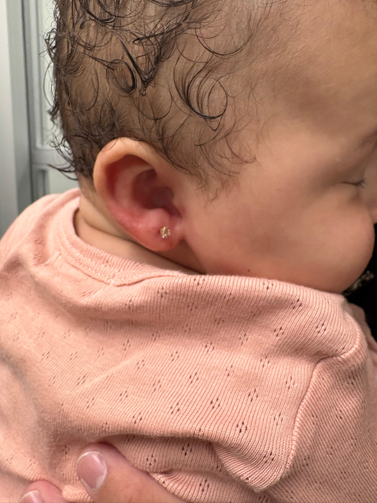 Infant Ear Piercing