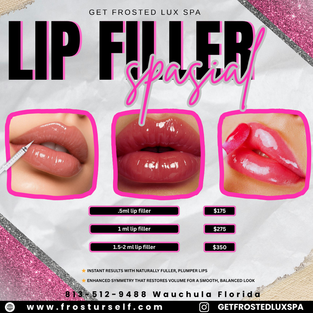 Lip Filler 1 ML Full at Get Frosted lux Spa in Wauchula, FL