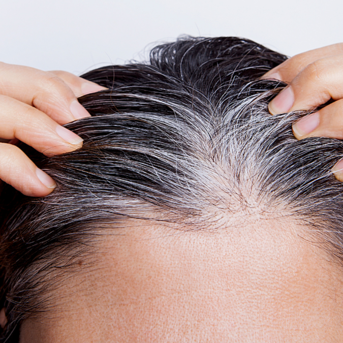 New Growth Re-touch at Empower Aesthetics in Canyon Lake, TX