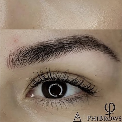 ✨ REFINEMENT SESSION (TOUCH-UP) at JLo  Clinic in Cape Coral, FL