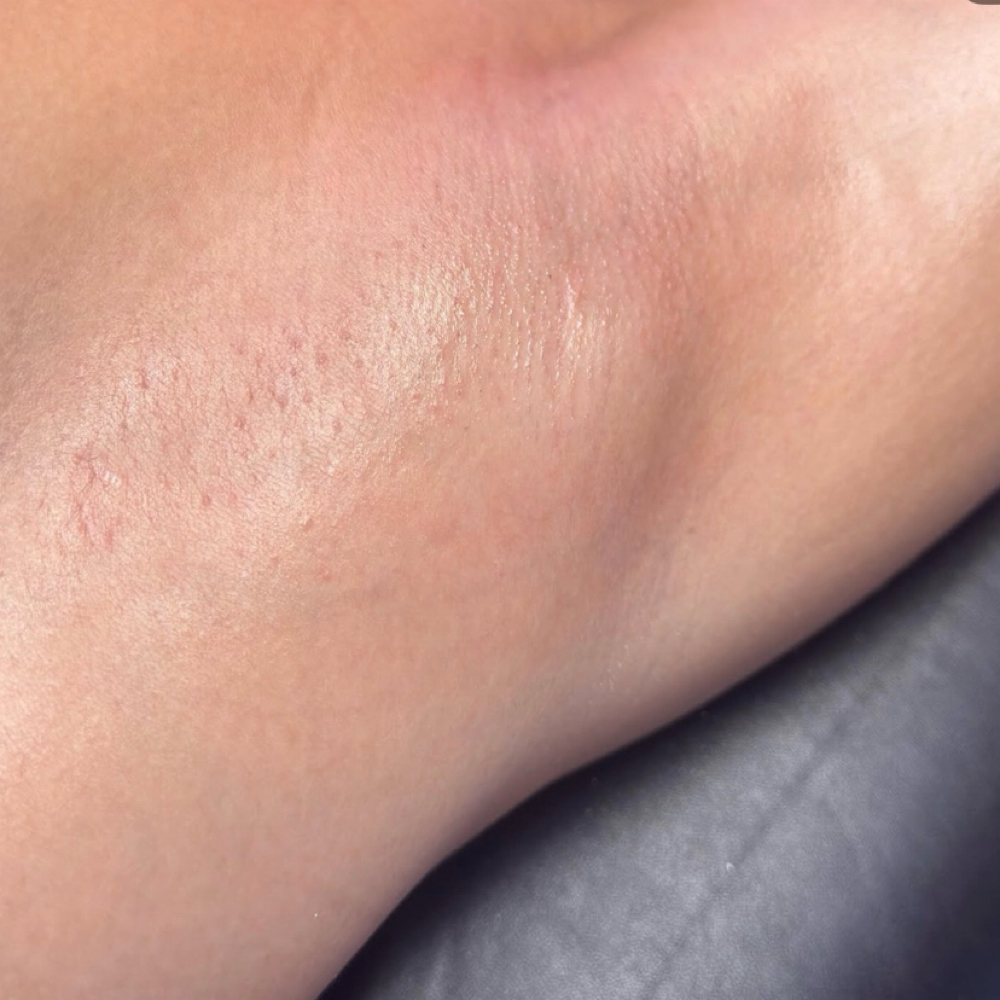 Underarm wax at Nailz.By.Nanni in Bryan, TX