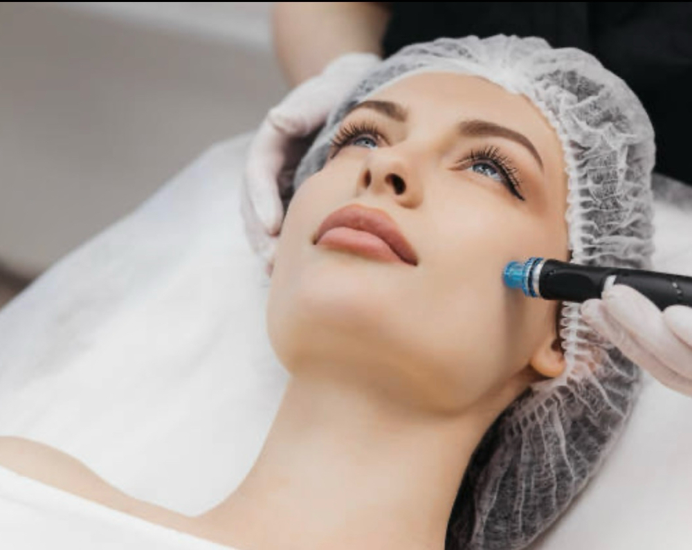Microneedling with Salmon DNA