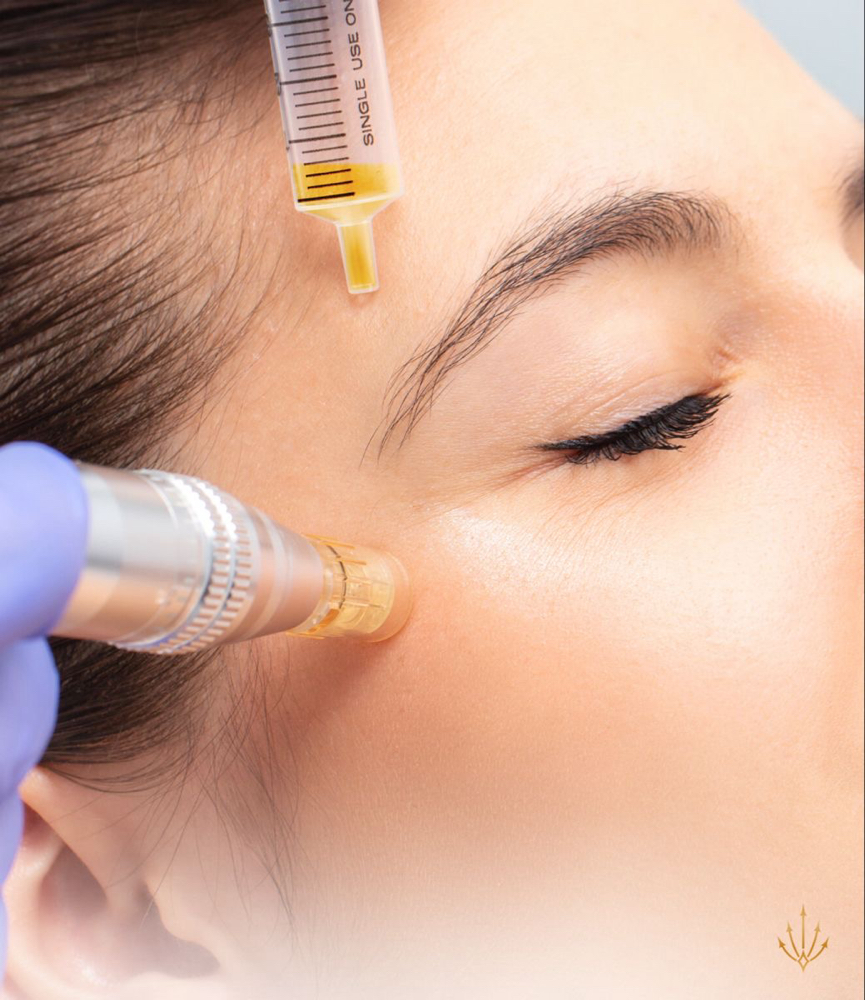 PRP Microneedling Package Of 3