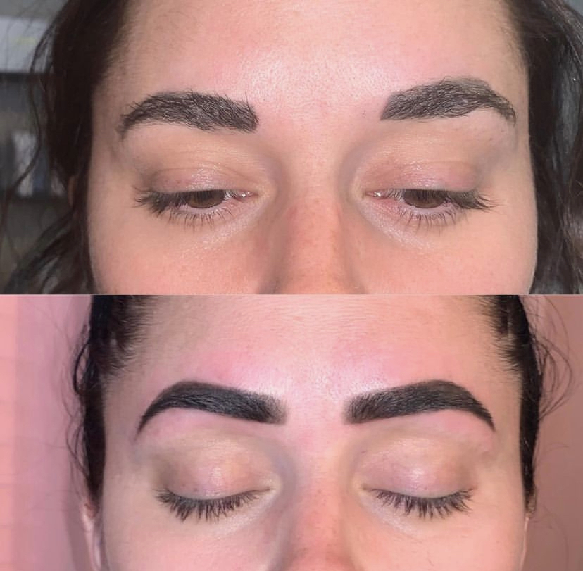 TrueBrow™ Natural Correction Pckg