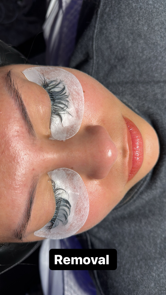 Eyelash Removal