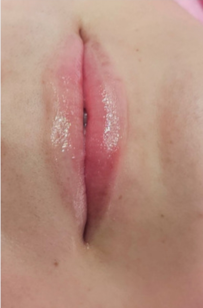 Labios 1.5 Ml