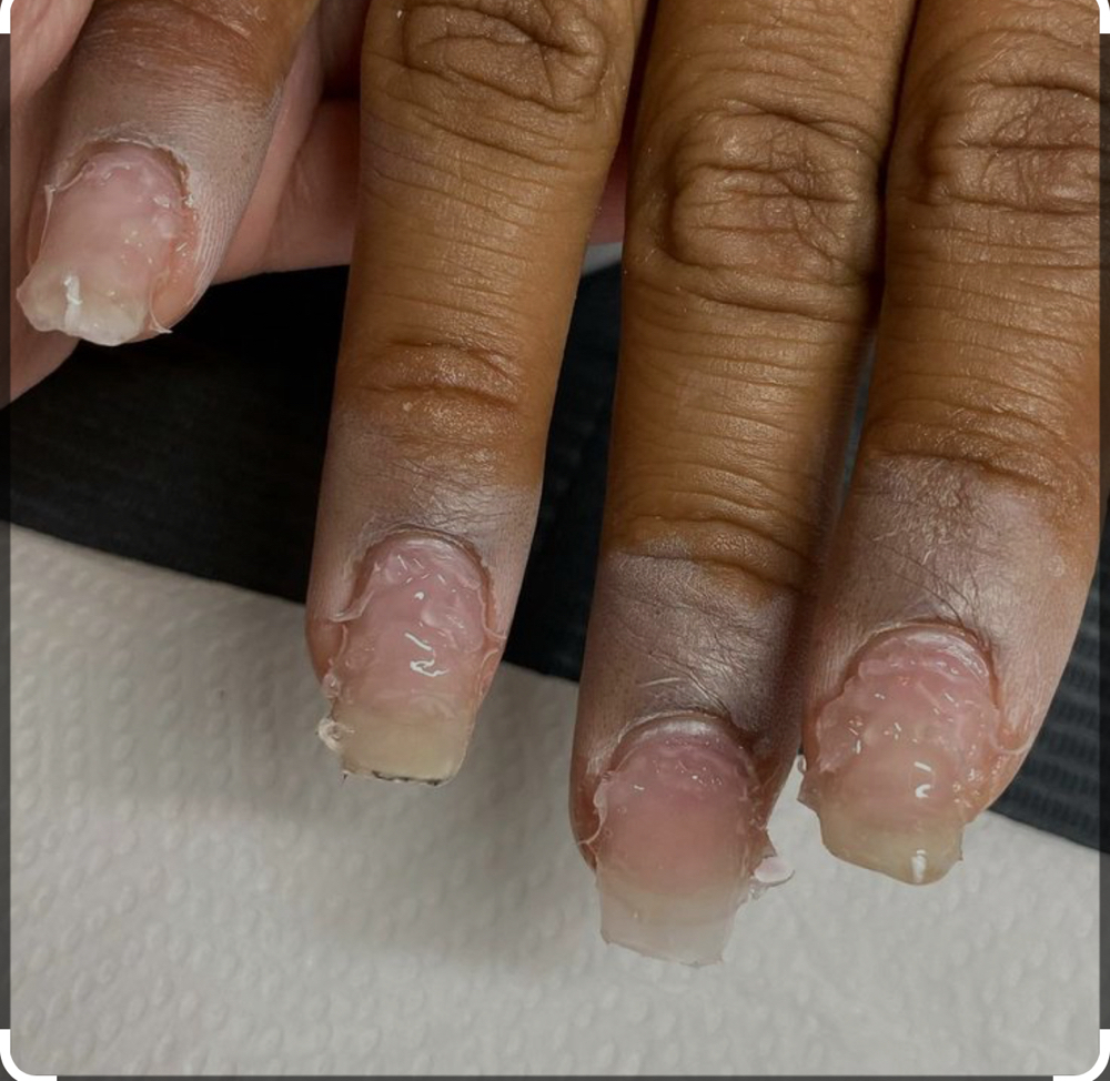 Acrylic Removals ( Foreign) 🛫