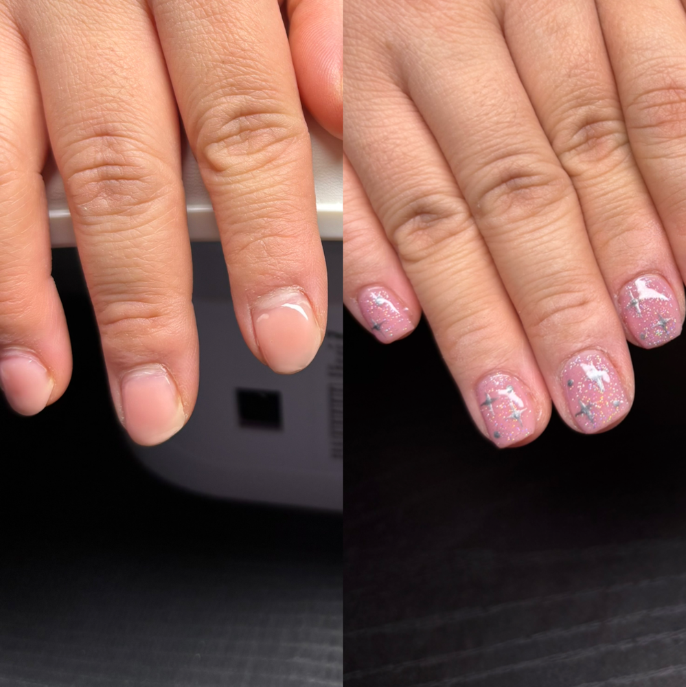 Structured Gel Fill