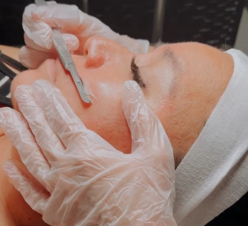 Dermaplane Service