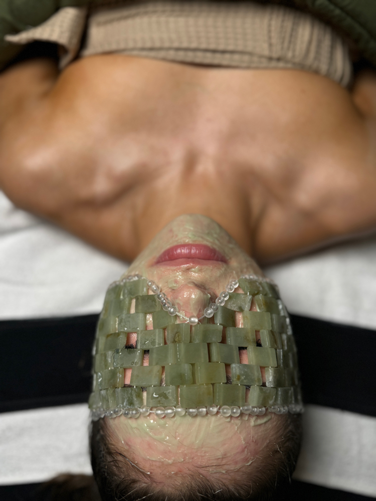Acne Facial