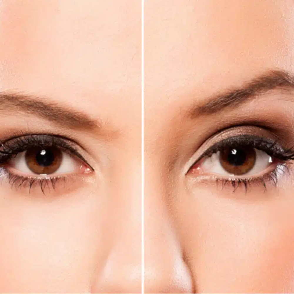Free Brow Lift Or Lip Flip at Monroe’s Everlasting Beauty in Corpus Christi, TX