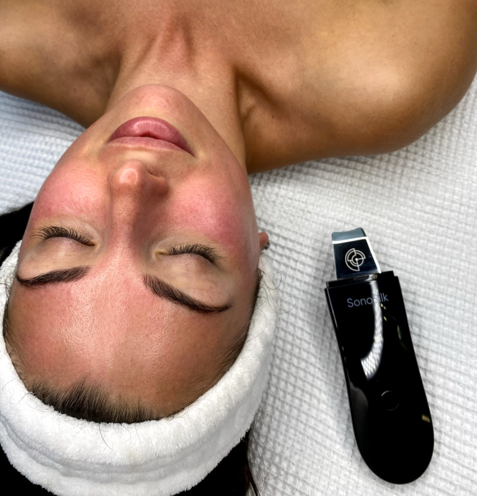 Acne Facial