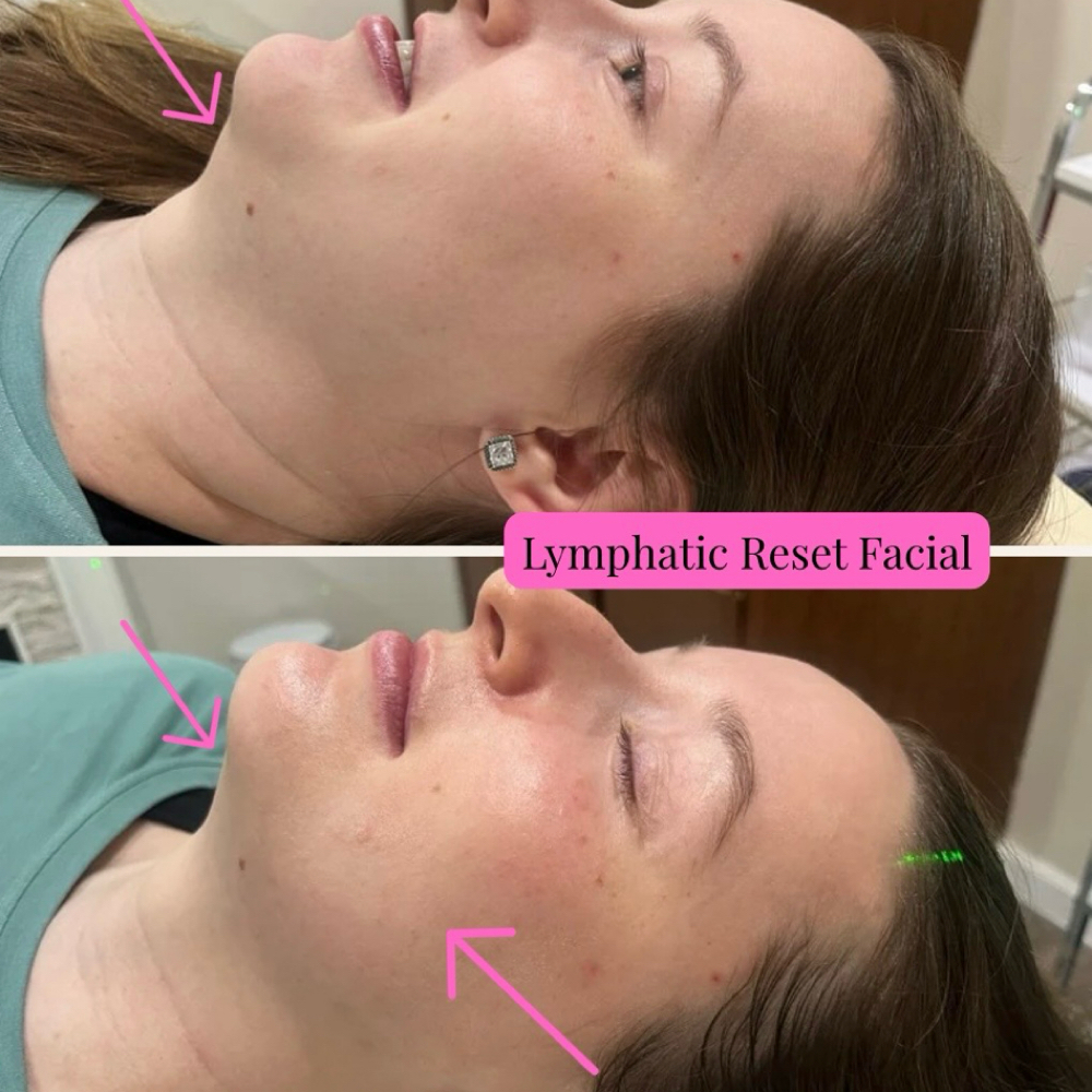 Lymphatic Reset Facial at Ashley G Aesthetics and Artistry in Evans, GA