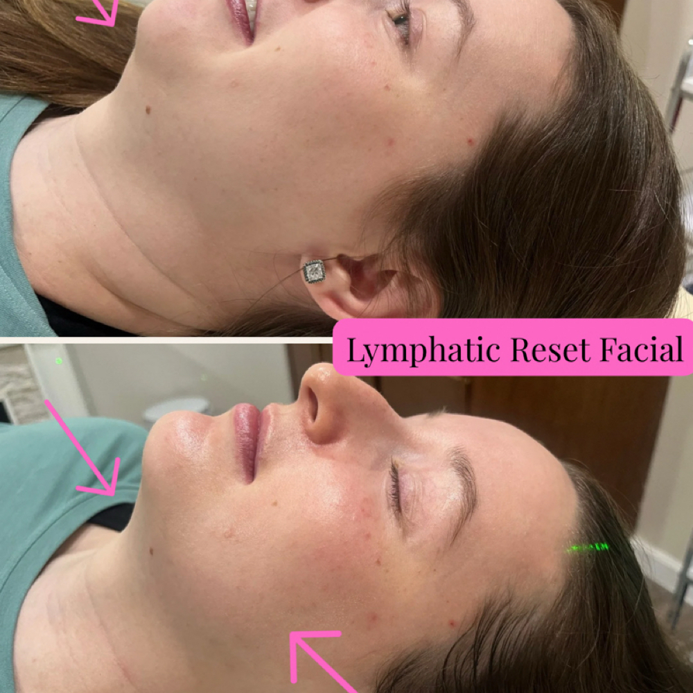 Lymphatic Reset Facial at Ashley G Aesthetics and Artistry in Evans, GA