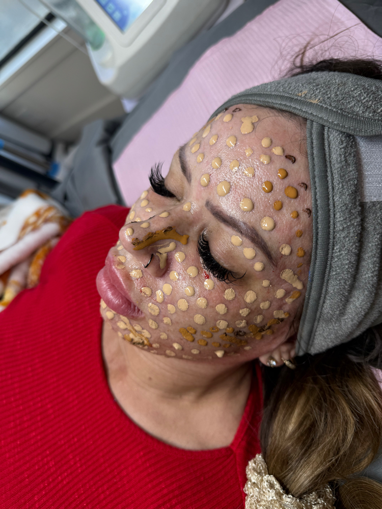 BB Glow + SERUM (2in1)